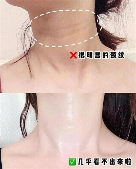 女人脖子有「三條槓」！每天堅持用它滾一滾，去皺緊膚不在話下 每日頭條