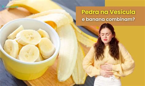 Quem Tem Pedra Na Vesícula Pode Comer Beterraba - Quem tem pedra na vesícula pode comer banana? Descubra agora mesmo!