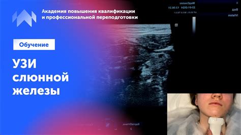 Узи для начинающих. Урок "УЗИ слюнной железы" - YouTube