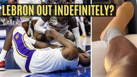 Lakers Lebron James Out Indefinitely Expert Explains Key Factors