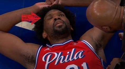 Why A Conspiracy Theory Joel Embiid Got Bell S Palsy From A Covid