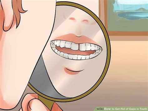 How To Make A Gap Between Your Teeth Teethwalls