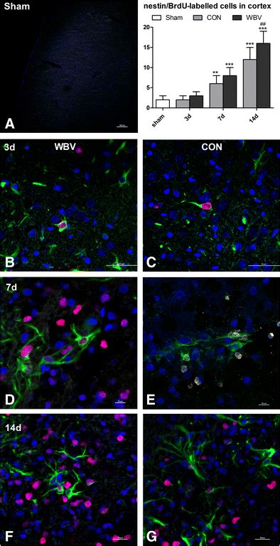 Representative Photomicrographs Of Brdu Nestin Red Green Cells From