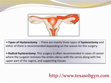 PPT - Reasons For Which A Woman Undergoes Hysterectomy PowerPoint