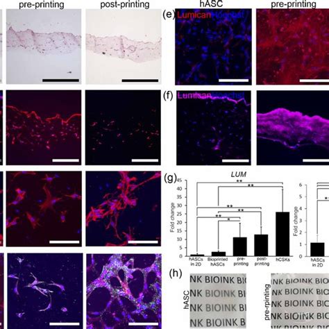 3D Bioprinting Strategies For Human Cornea Stroma Structures A HE