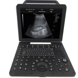 Needle Guidance Ultrasound System DW P60 Dawei Medical Portable