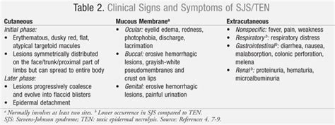 Steven Johnson Syndrome Treatment Options