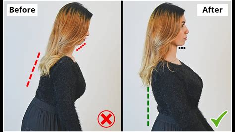 Just 3 Steps To Fix Your Posture Permanently No Exercise No Secret