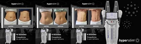 Hyper Slim - Aparelho Estimulador Muscular - Medical San | BCMED