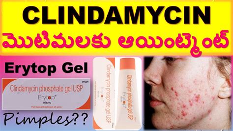 CLINDAMYCIN ERYTOP GEL Uses Composition Working How To Apply Side