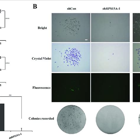 Lentivirus Mediated Knockdown Of RPS15A Suppresses Cell Viability And