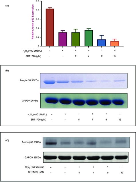 Effect Of Srt On Acetyl P By Western Blot A Srt