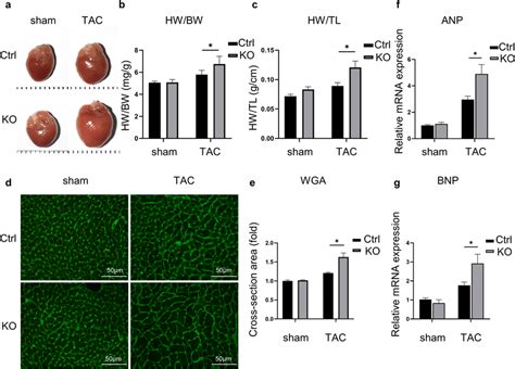 FABP5 Deficiency Exacerbated TAC Induced Cardiac Hypertrophy A