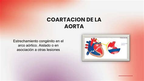 Cardiopatia Congenitas Clasificacion Presentacion Clinicas Y