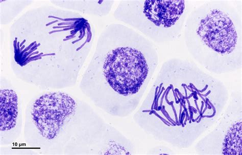 Mitosis Fases Divisi N Celular Y Su Importancia En Organismos