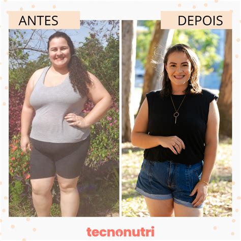 Remoção De Costelas Antes E Depois - Costeleta Feminina Antes E Depois - RETOEDU