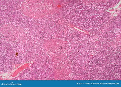 Thymus Gland Histology Labeled