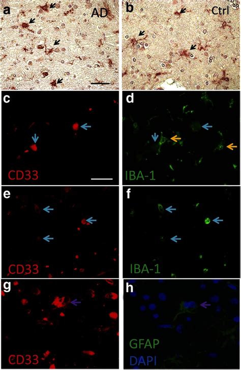 Cd33 Alzheimers Risk Altering Polymorphism Cd33 Expression And Exon