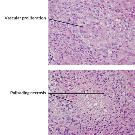 Pathology