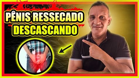 PÊnis Ressecado E Descamando Descascando Quais As Causas E O Que Fazer Para Resolver Esse