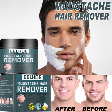 how remove face hair permanently 2