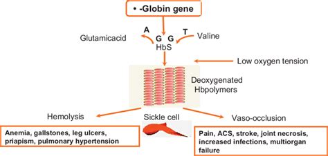 Pathophysiology Of Sickle Cell Disease ACS Acute Chest Syndrome Hbs