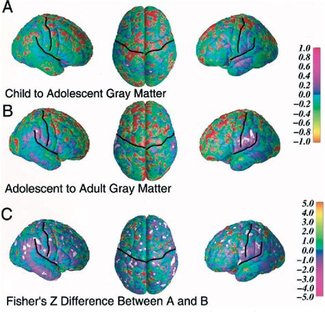 Figure 1 From Mapping Continued Brain Growth And Gray Matter Density