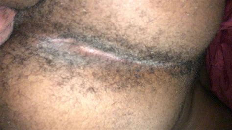 My Hairy Ass Video ThisVid