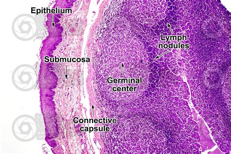Pharyngeal Tonsil Histology