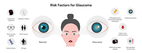 Premium Vector Risk Factors For Glaucoma Disease Optometry