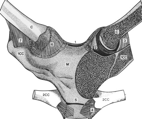 Instability Of The Sternoclavicular Joint Bone And Joint