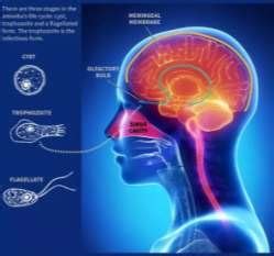 Brain-eating amoeba life cycle (Karl Tate, 2013) Disease and Symptoms ...