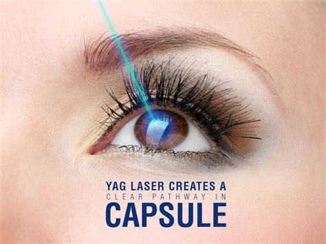 Argon Laser Yag Laser Orbit Eye Hospital Mumbai