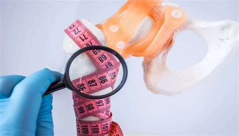When do growth plates close? delving into development