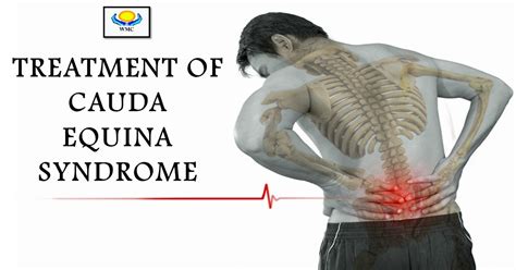 Rehabilitation Care Centre Treatment Of Cauda Equina Syndrome