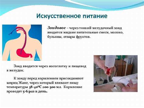 Организация питания в стационаре Кормление тяжелобольных пациентов ПМ