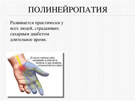 Полинейропатии профилактика: Полинейропатия нижних и верхних ...