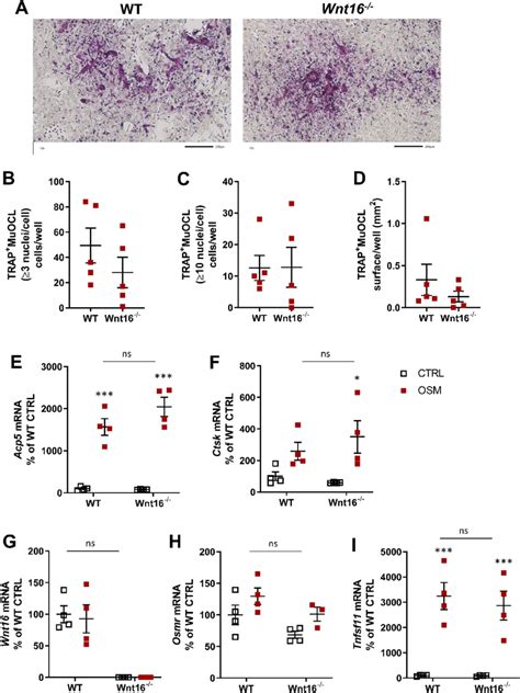 Osteoclastogenesis Stimulated By OSM Is Unchanged In Primary Bone