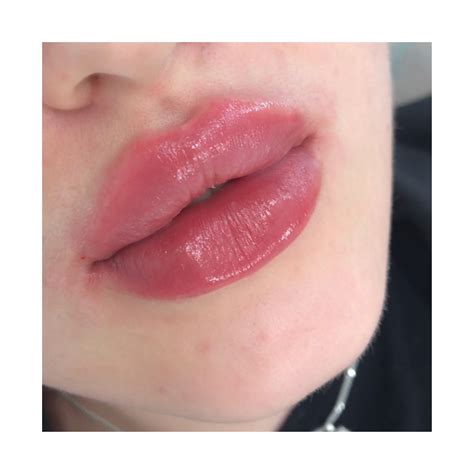 Pin by Konney Mykaelly Ferreira on face | Lips inspiration, Botox lips ...