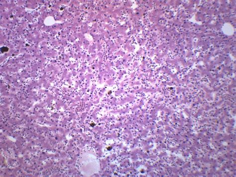 Frog Liver, Section - Prepared Microscope Slide | Microscope slides