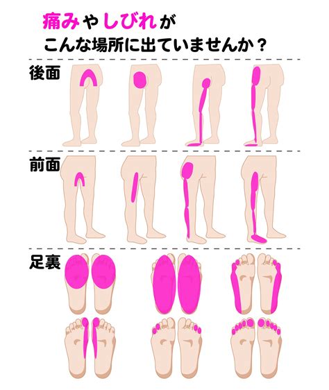 坐骨神経痛とはその症状と原因や日常生活での予防法をご紹介 骨盤矯正・産後骨盤矯正専門ボディケアサロン│骨盤labo