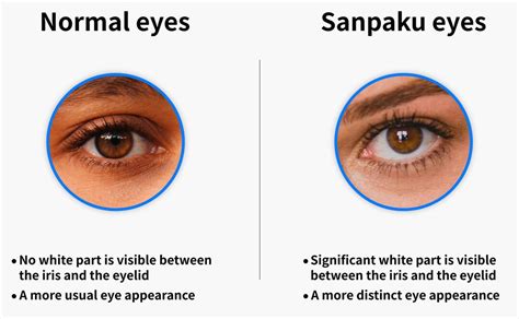 The Spiritual Meaning Of Sanpaku Eyes Unveiling The Profound Symbolism