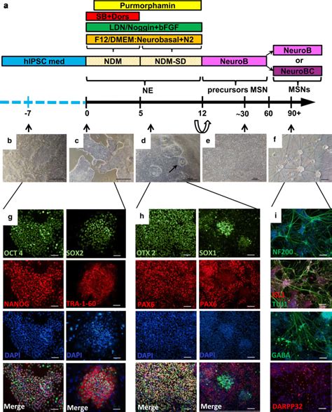 IPSCs Differentiate Into MSNs A Scheme Of The Differentiation