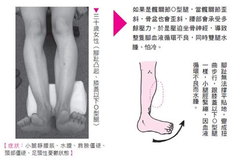 身體90 的疼痛都是因為「腿歪斜」！日本骨科權威：「抬膝走路」才是健康秘訣 良醫健康網