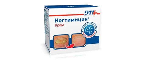 ТОП-10: Лучшее средство от грибка ногтей рейтинг 2019