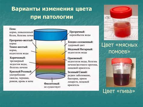 Общий анализ мочи. Физические свойства мочи - презентация онлайн
