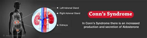 Conns Syndrome Primary Hyperaldosteronism Causes Symptoms