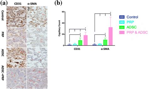 Vessel Formation Of The Scaffolds Assessed By Cd And Sma After