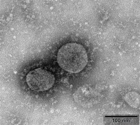 Coronaviruses in creation