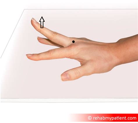 trigger finger rehab  patient